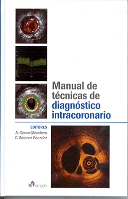MANUAL DE TECNICAS DE DIAGNOSTICO INTRACORONARIO