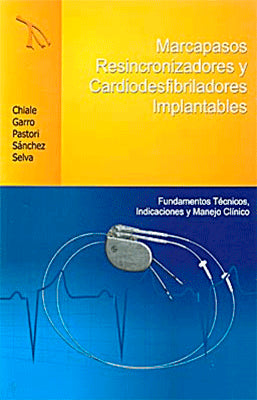 MARCAPASOS RESINCRONIZADORES Y CARDIODESFIBRILADORES IMPLANTABLES