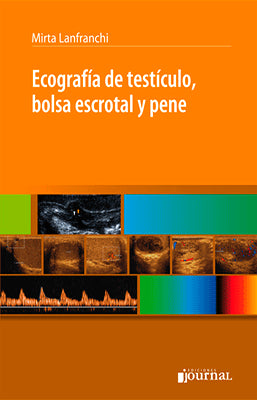ECOGRAFIA DE TESTICULO, BOLSA ESCROTAL Y PENE