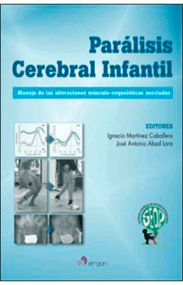 PARALISIS CEREBRAL INFANTIL MANEJO DE LAS ALTERACIONES MUSCULOESQUELETICAS ASOCIADAS