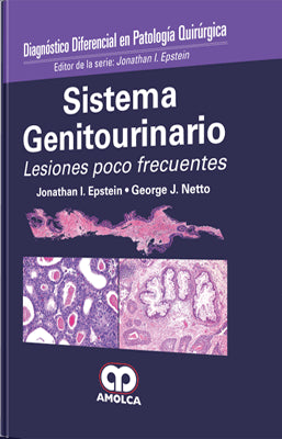 SISTEMA GENITOURINARIO
