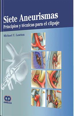 SIETE ANEURISMAS