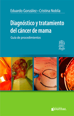 DIAGNOSTICO Y TRATAMIENTO DEL CANCER DE MAMA