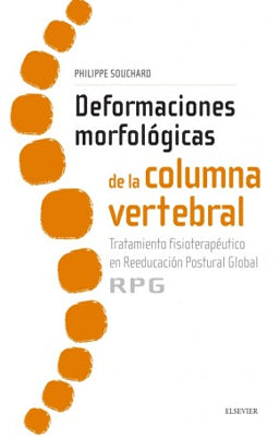 DEFORMACIONES MORFOLOGICAS DE LA COLUMNA VERTEBRAL