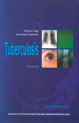 TUBERCULOSIS 3ERA EDICION