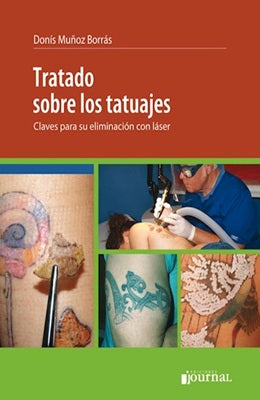 TRATADO SOBRE TATUAJES CLAVES PARA SU ELIMINACION CON LASER