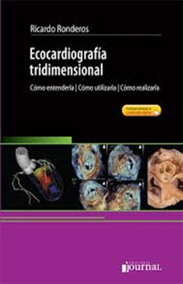 ECOCARDIOGRAFIA TRIDIMENSIONAL COMO ENTENDERLA COMO UTILIZARLA COMO REALIZARLA