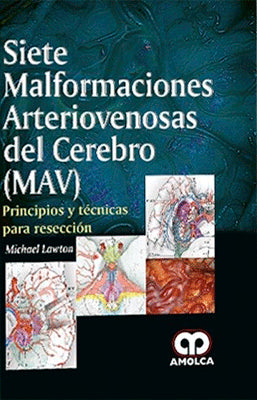 SIETE MALFORMACIONES ARTERIOVENOSAS DEL CEREBRO MAV