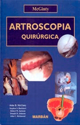 ARTROSCOPIA QUIRURGICA