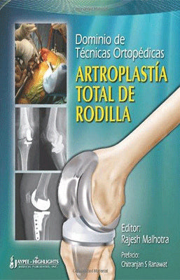 DOMINIO DE TECNICAS ORTOPEDICAS ARTROPLASTIA TOTAL DE RODILLA