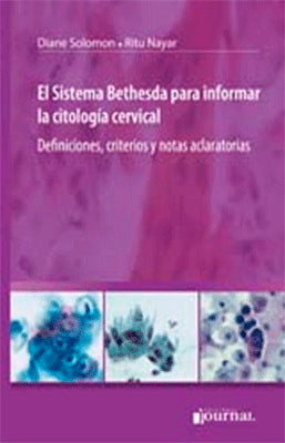 EL SISTEMA BETHESDA PARA INFORMAR LA CITOLOGIA CERVICAL
