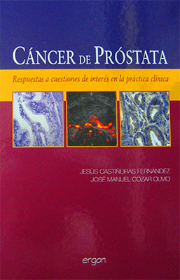 MANEJO TERAPEUTICO DEL PACIENTE CON CANCER DE PROSTATA METASTASICO RESISTENTE A LA CASTRACION