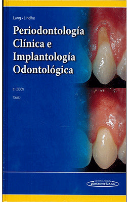 PERIODONTOLOGIA CLINICA E IMPLANTOLOGIA ODONTOLOGICA 6TA. EDIC. TOMO 2