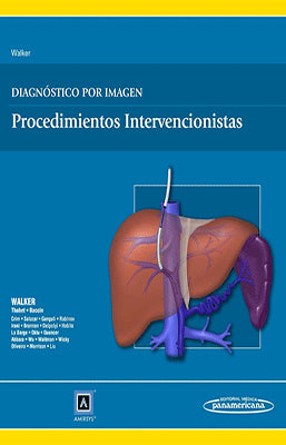 DIAGNOSTICO POR IMAGEN PROCEDIMIENTOS INTERVENCIONISTAS