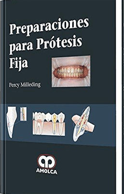 PREPARACIONES PARA PROTESIS FIJA