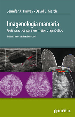 IMAGENOLOGIA MAMARIA GUIA PRACTICA PARA UN MEJOR DIAGNOSTICO