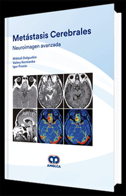 METASTASIS CEREBRALES NEUROIMAGEN AVANZADA