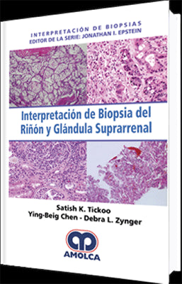 INTERPRETACION  DE BIOPSIA DEL RIÑON Y GLANDULA SUPRARRENAL