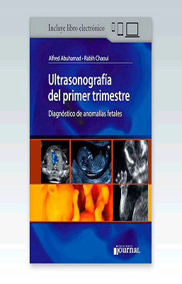 ULTRASONOGRAFIA DEL PRIMER TRIMESTRE