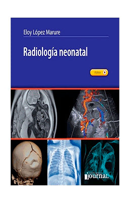 RADIOLOGIA NEONATAL