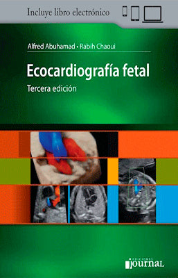 ECOCARDIOGRAFIA FETAL