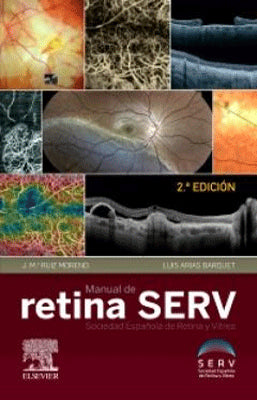 MANUAL DE RETINA SERV 2ED