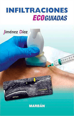 INFILTRACIONES ECOGUIADAS