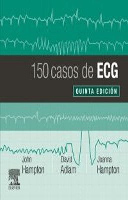 150 CASOS DE ECG 5ED
