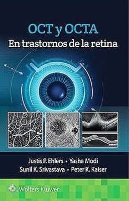 OCT Y OCTA EN TRASTORNOS DE LA RETINA