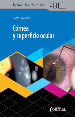 CORNEA Y SUPERFICIE OCULAR