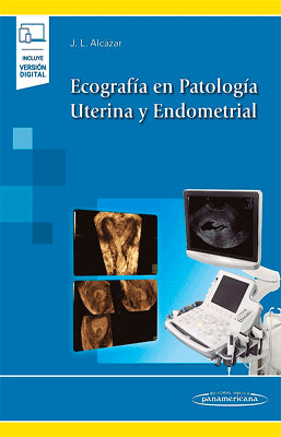 ECOGRAFIA EN PATOLOGIA UTERINA Y ENDOMETRIAL