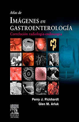 ATLAS DE IMAGENES EN GASTROENTEROLOGIA