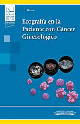 ECOGRAFIA EN LA PACIENTE CON CANCER GINECOLOGICO