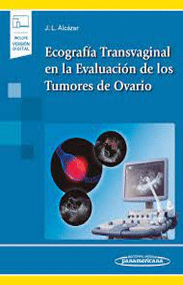 ECOGRAFIA TRANSVAGINAL EN LA EVALUACION DE LOS TUMORES DE OVARIO