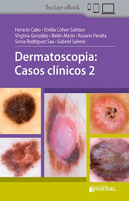 DERMATOSCOPIA CASOS CLINICOS