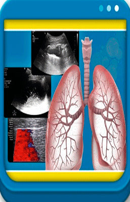 EBOOK ECOGRAFIA PULMONAR
