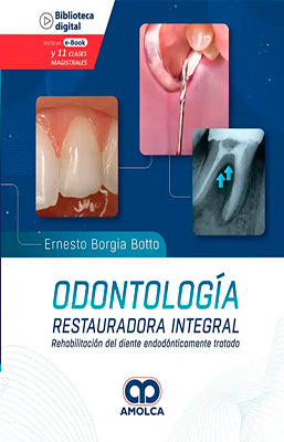 ODONTOLOGIA RESTAURADORA INTEGRAL REHABILITACION DEL DIENTE ENDODONTICAMENTE TRATADO