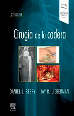 CIRUGIA DE LA CADERA 2ED