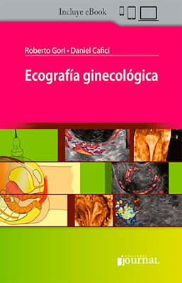 ECOGRAFIA GINECOLOGICA 2ED