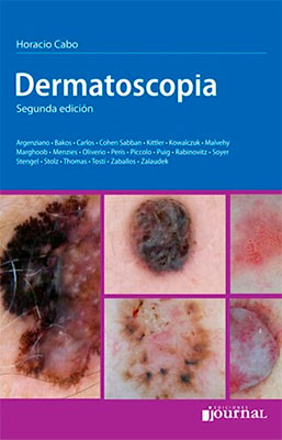 EBOOK DERMATOSCOPIA 2ED