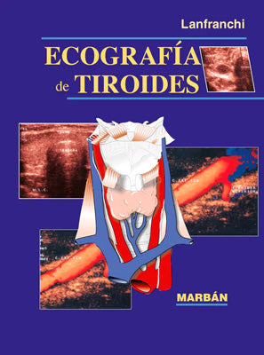 ECOGRAFIA DE TIROIDES