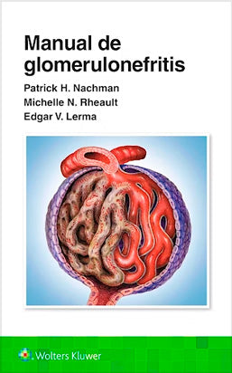 MANUAL DE GLOMERULONEFRITIS