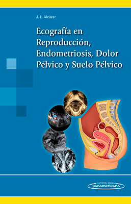 ECOGRAFIA EN REPRODUCCION ENDOMETRIOSIS DOLOR PELVICO Y SUELO PELVICO