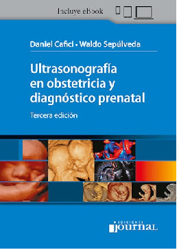 ULTRASONOGRAFIA EN OBSTETRICIA Y DIAGNOSTICO PRENATAL