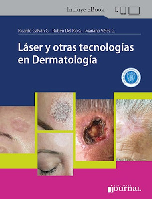 LASER Y OTRAS TECNOLOGIAS EN DERMATOLOGIA