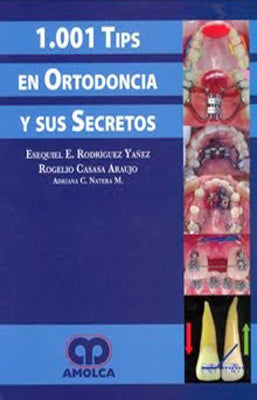 1001 TIPS EN ORTODONCIA Y SUS SECRETOS