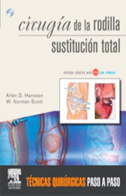 CIRUGIA DE LA RODILLA SUSTITUCION TOTAL