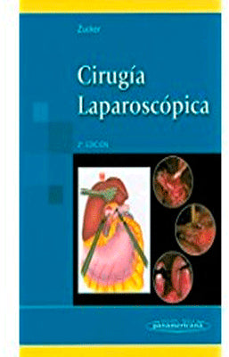 CIRUGIA LAPAROSCOPICA 2DA.