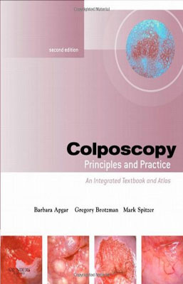 COLPOSCOPIA PRINCIPIOS Y PRACTICA +DVD