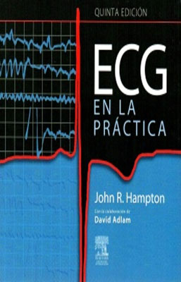 ECG EN LA PRACTICA